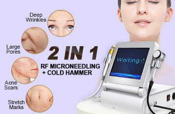 fractional rf hkr microneedling