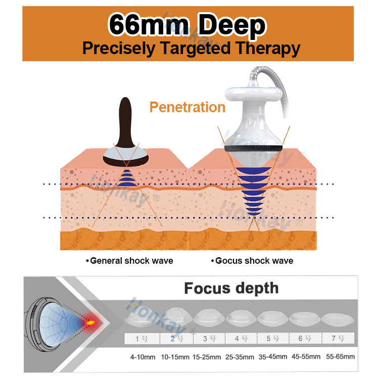 focused shockwave therapy machine cost