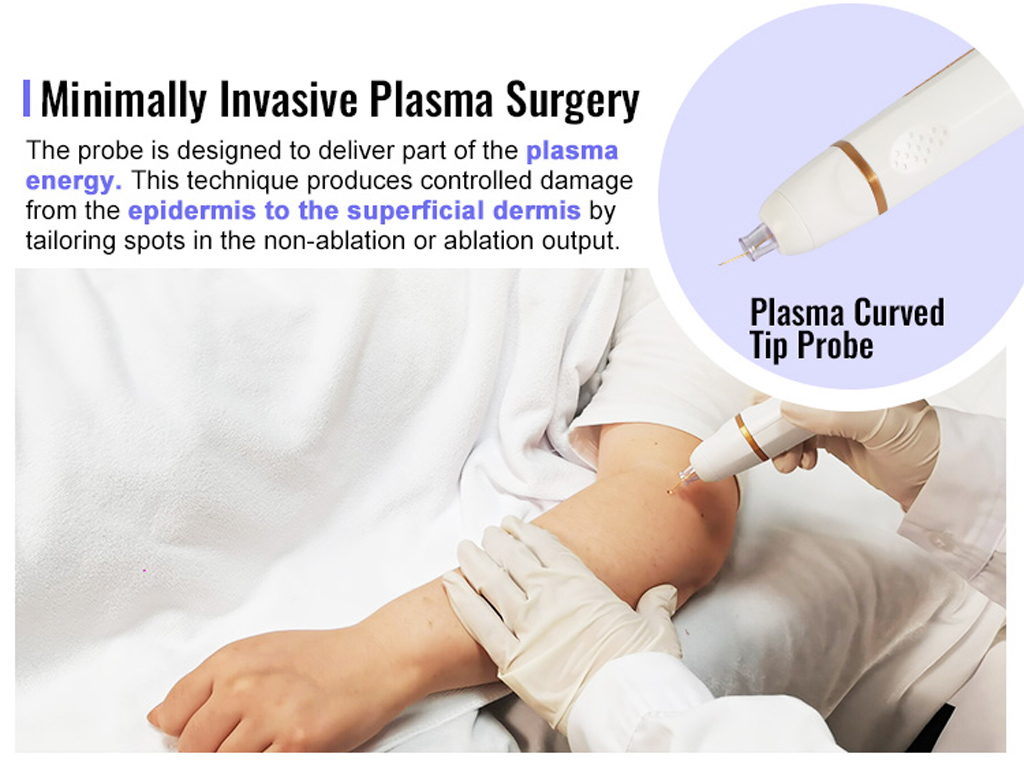 Plasma Curved Tip Probe