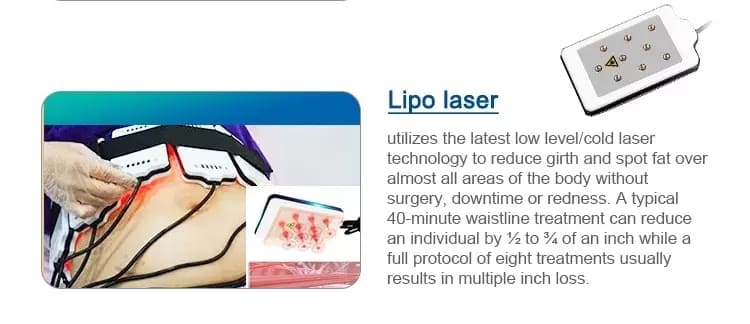 cryolipolysis lipo laser