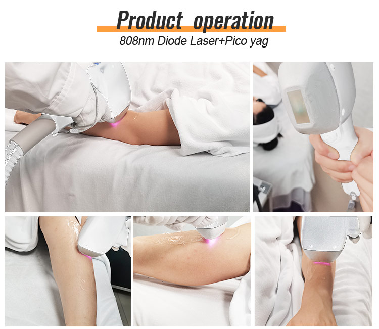 how to use diode laser hair removal machine