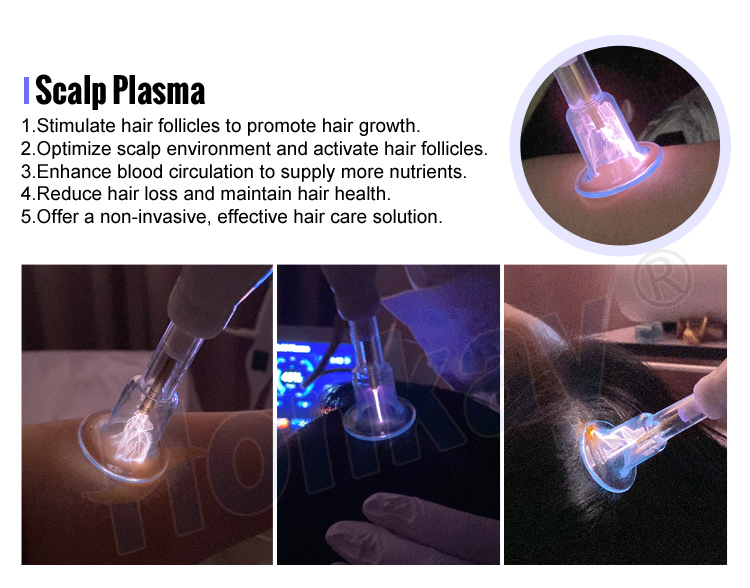 scalp plasma