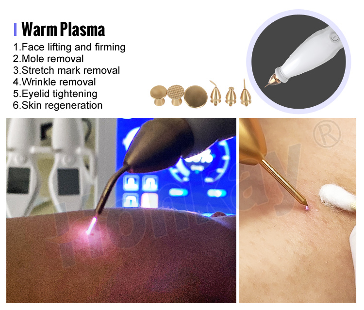 warm plasma pen