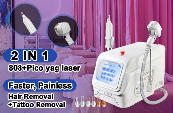 new laser tattoo removal