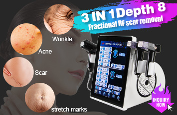 fractional rf microneedling machine