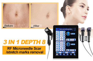 fractional rf stretch microneedling machine